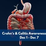 A detailed 3D medical illustration of the human digestive system highlighting the intestines, representing Crohn’s and Colitis Awareness Week.